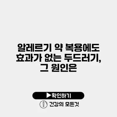 알레르기 약 복용에도 효과가 없는 두드러기, 그 원인은?